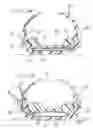 Fig. 09 - Wrist supports