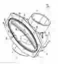 Fig. 11 - Diaphargm valve and open close element for said valve