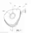 Fig. 02 - Eyeglass manufacturing method using variable index layer