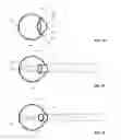 Fig. 02 - Temporal vision modification