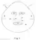 Fig. 02 - Treatment articles capable of conforming to an underlying shape