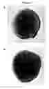 Fig. 02 - Compositions and methods for neural differentiation of embryonic stem cells