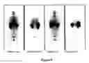 Fig. 08 - Therapeutic agent