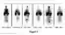 Fig. 09 - Therapeutic agent