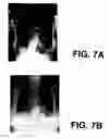 Fig. 08 - Segmenting occluded anatomical structures in medical images