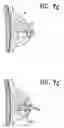 Fig. 08 - Imageable biopsy site marker