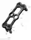 Fig. 02 - Locking bone screw and spinal plate system