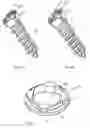 Fig. 06 - Locking bone screw and spinal plate system