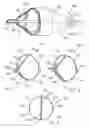 Fig. 02 - Support frame for an embolic protection device