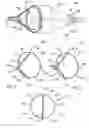 Fig. 02 - Support frame for an embolic protection device