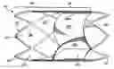 Fig. 01 - Stent and method of manufacturing same