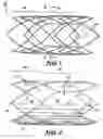 Fig. 02 - Stent and method of manufacturing same