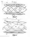 Fig. 02 - Stent valve and method of manufacturing same