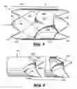 Fig. 03 - Stent valve and method of manufacturing same