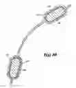 Fig. 06 - Stent valve and method of manufacturing same