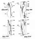Fig. 07 - Stent valve and method of manufacturing same