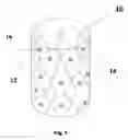 Fig. 02 - Methods and apparatus for in vivo cell therapy
