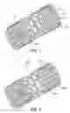 Fig. 02 - Expandable medical device with openings for delivery of multiple beneficial agents