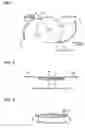 Fig. 02 - Single piece intraocular lens and method for producing same
