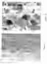 Fig. 03 - Synthetic bone graft biomaterial
