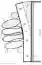 Fig. 33 - Automatic patient turner