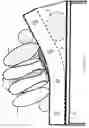 Fig. 35 - Automatic patient turner