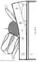 Fig. 43 - Automatic patient turner