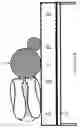 Fig. 45 - Automatic patient turner