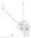 Fig. 02 - Tree trimmer