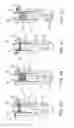 Fig. 05 - System and method for recovering wasted energy from an internal combustion engine