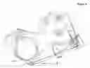 Fig. 05 - System for restraining head and neck movement