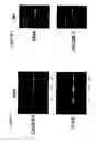 Fig. 06 - Compositions containing macrophages and uses thereof