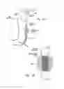 Fig. 13 - Anti-angiogenic compositions and methods of use