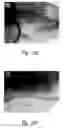 Fig. 18 - Anti-angiogenic compositions and methods of use