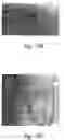 Fig. 20 - Anti-angiogenic compositions and methods of use