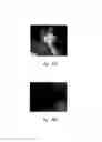 Fig. 33 - Anti-angiogenic compositions and methods of use