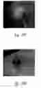 Fig. 34 - Anti-angiogenic compositions and methods of use