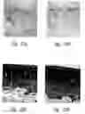 Fig. 37 - Anti-angiogenic compositions and methods of use