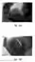 Fig. 76 - Anti-angiogenic compositions and methods of use