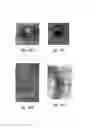 Fig. 77 - Anti-angiogenic compositions and methods of use
