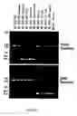 Fig. 02 - Delete sequence in , method for detecting mycobacteria using these sequences and vaccines