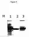 Fig. 07 - Rapid diagnostic methods of Peste des Petits Ruminants using recombinant nucleocapsid protein expressed in insect cells and monoclonal antibody