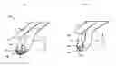 Fig. 02 - INTERCHANGEABLE TISSUE MACERATING AND SCULPTING METHODS AND DEVICES