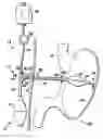 Fig. 01 - Gastro-occlusive device
