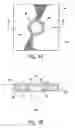 Fig. 04 - Systems and methods for securing fractures using plates and cable clamps