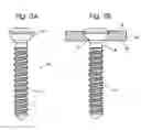 Fig. 06 - Systems and methods for securing fractures using plates and cable clamps