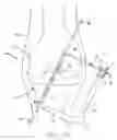 Fig. 16 - Method and apparatus for fixing a graft in a bone tunnel