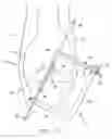 Fig. 17 - Method and apparatus for fixing a graft in a bone tunnel