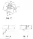 Fig. 45 - Method and apparatus for fixing a graft in a bone tunnel