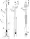 Fig. 04 - Implantable medical devices, and methods of delivering the same